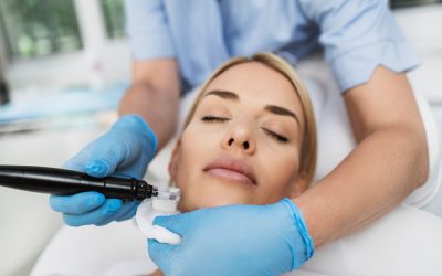 How Does Micro-needling Work to Enhance Acne Correction?