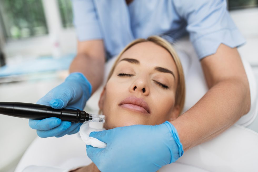 How Does Microneedling Work to Enhance Acne Correction? Aesthetic Lane